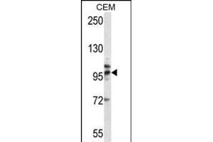 TLR2 Antibody (Center) (ABIN657617 and ABIN2846613) western blot analysis in CEM cell line lysates (35 μg/lane). (TLR2 antibody  (AA 281-310))