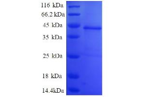 SDS-PAGE (SDS) image for C1D Nuclear Receptor Corepressor (C1D) (AA 1-135), (partial) protein (GST tag) (ABIN7479613) (C1D Protein (AA 1-135, partial) (GST tag))