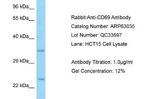 Western Blotting (WB) image for anti-CD69 (CD69) (Middle Region) antibody (ABIN970343) (CD69 antibody  (Middle Region))