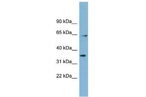 WB Suggested Anti-RANGAP1 Antibody Titration: 0. (RANGAP1 antibody  (N-Term))