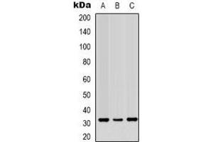 Western blot analysis of PORIN expression in Jurkat (A), Hela (B), A431 (C) whole cell lysates. (PORIN (N-Term) antibody)