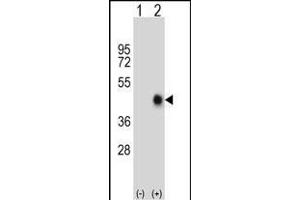 Western blot analysis of FAS (arrow) using rabbit polyclonal FAS Antibody (Center) (ABIN652469 and ABIN2842320). (FAS antibody  (AA 185-211))