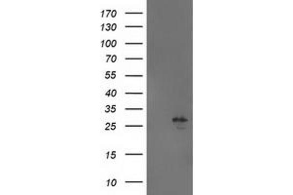 AK4 antibody