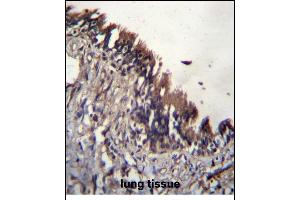 NUDT9 Antibody (C-term) (ABIN656174 and ABIN2845504) immunohistochemistry analysis in formalin fixed and paraffin embedded human lung tissue followed by peroxidase conjugation of the secondary antibody and DAB staining. (NUDT9 antibody  (C-Term))
