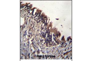 NUDT9 Antibody (C-term) (ABIN656174 and ABIN2845504) immunohistochemistry analysis in formalin fixed and paraffin embedded human lung tissue followed by peroxidase conjugation of the secondary antibody and DAB staining.