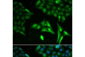 Immunofluorescence analysis of U2OS cells using ACADS Polyclonal Antibody