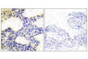 Immunohistochemistry (IHC) image for anti-Ribosomal Protein S6 Kinase, 70kDa, Polypeptide 1 (RPS6KB1) (Internal Region) antibody (ABIN1849254) (RPS6KB1 antibody  (Internal Region))