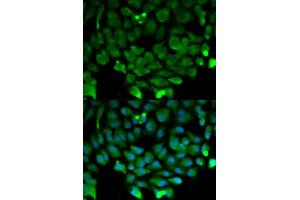 Immunofluorescence analysis of HeLa cell using CUL3 antibody. (Cullin 3 antibody  (AA 569-768))