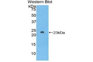 Western Blotting (WB) image for anti-Dishevelled, Dsh Homolog 2 (Drosophila) (DVL2) (AA 78-250) antibody (ABIN1858675) (DVL2 antibody  (AA 78-250))