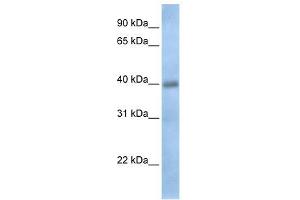 TXNDC15 antibody used at 1 ug/ml to detect target protein. (TXNDC15 antibody  (C-Term))