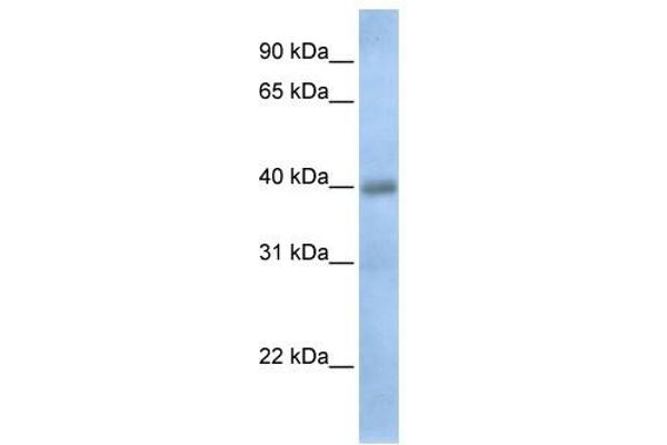 TXNDC15 antibody  (C-Term)