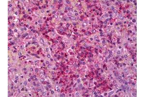 Anti-IL6R antibody IHC of human spleen. (IL-6 Receptor antibody)