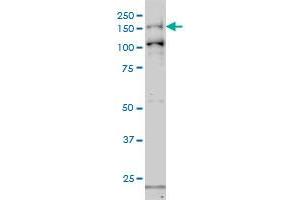 GAK monoclonal antibody (M01), clone 4C10 Western Blot analysis of GAK expression in Hela S3 NE . (GAK antibody  (AA 151-250))