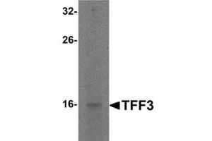 Western blot analysis of TFF3 in rat small intestine tissue lysate with TFF3 antibody at 2 μg/ml.