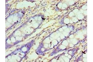 Immunohistochemistry of paraffin-embedded human colon tissue using ABIN7148780 at dilution of 1:100