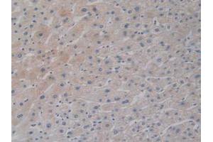 IHC-P analysis of Human Liver Tissue, with DAB staining. (DCLK1 antibody  (AA 390-647))