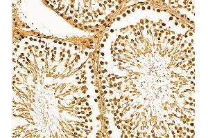 ABIN7094608 and ABIN7098658 at 1/100 staining Rat testis tissue by IHC-P. (MCM10 antibody  (C-Term))