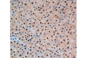 #VALUE! (BNP antibody)
