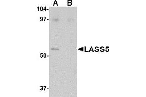 Western Blotting (WB) image for anti-LAG1 Homolog, Ceramide Synthase 5 (LASS5) (C-Term) antibody (ABIN1030478) (LASS5 antibody  (C-Term))