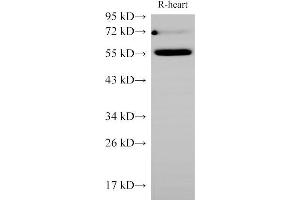 Western Blot analysis of Rat Heart using Ceacam1 Polycloanl Antibody at dilution of 1:1000 (CEACAM1 antibody)