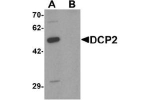 Western blot analysis of DCP2 in 293 cell lysate with DCP2 Antibody  at 1 μg/ml in (A) the absence and (B) the presence of blocking peptide.