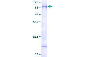 Image no. 1 for Carbohydrate (N-Acetylgalactosamine 4-Sulfate 6-O) Sulfotransferase 15 (CHST15) (AA 1-561) protein (GST tag) (ABIN1354721) (CHST15 Protein (AA 1-561) (GST tag))