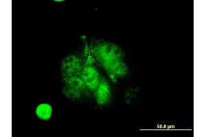 Immunofluorescence of monoclonal antibody to MEF2A on MCF-7 cell. (MEF2A antibody  (AA 71-170))