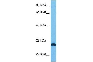 Host:  Rabbit  Target Name:  SUN1  Sample Tissue:  Human HCT116 Whole Cell  Antibody Dilution:  1ug/ml (SUN1 antibody  (N-Term))