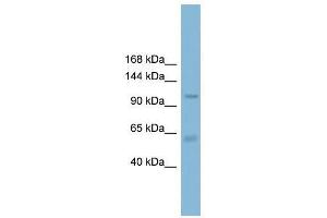 Western Blot showing CLCA2 antibody used at a concentration of 1-2 ug/ml to detect its target protein. (CLCA2 antibody  (C-Term))