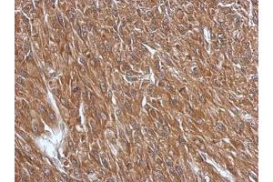 IHC-P Image Immunohistochemical analysis of paraffin-embedded U87 xenograft, using GPR37L1, antibody at 1:500 dilution. (GPR37L1 antibody  (C-Term))