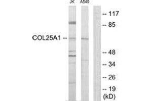 Western Blotting (WB) image for anti-Collagen, Type XXV, alpha 1 (COL25A1) (AA 101-150) antibody (ABIN2889929) (COL25A1 antibody  (AA 101-150))