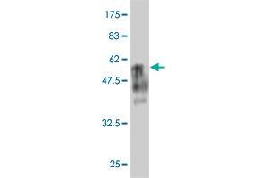 Western Blot detection against Immunogen (48. (BTG4 antibody  (AA 1-206))