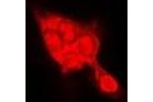Immunofluorescent analysis of SELENBP1 staining in Hela cells. (SELENBP1 antibody)