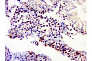 Paraformaldehyde-fixed, paraffin embedded rat testis, Antigen retrieval by boiling in sodium citrate buffer (pH6) for 15min, Block endogenous peroxidase by 3% hydrogen peroxide for 30 minutes, Blocking buffer (normal goat serum) at 37°C for 20min, Antibody incubation with CST8 Polyclonal Antibody, Unconjugated  at 1:500 overnight at 4°C, followed by a conjugated secondary and DAB staining. (CST8 antibody)