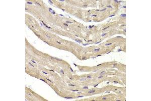 Immunohistochemistry of paraffin-embedded Mouse heart using COPS3 antibody at dilution of 1:100 (x400 lens). (COPS3 antibody)