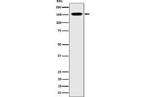 Western blot analysis of NUP155 expression in 293 cell lysate. (Recombinant NUP155 antibody)