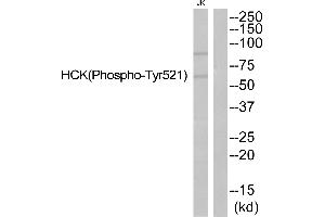 Western blot analysis of extracts from JurKat cells, using HCK (Phospho-Tyr521) antibody. (HCK antibody  (pTyr521))