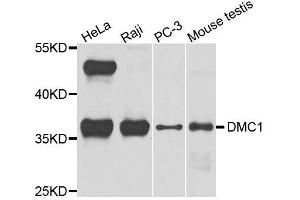 Western blot analysis of extracts of various cell lines, using DMC1 antibody. (DMC1 antibody  (AA 1-260))