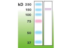 Western Blotting (WB) image for anti-Nitric Oxide Synthase 2, Inducible (NOS2) antibody (ABIN870301) (NOS2 antibody)