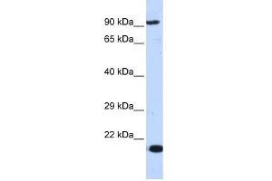 MCM7 antibody used at 1 ug/ml to detect target protein. (MCM7 antibody  (Middle Region))