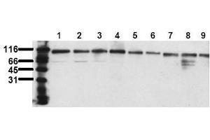 Western Blotting (WB) image for anti-Topoisomerase (DNA) I (TOP1) antibody (ABIN126904) (Topoisomerase I antibody)