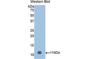 Western blot analysis of the recombinant protein. (Vitamin D-Binding Protein antibody  (AA 395-473))