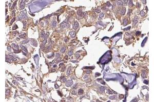 Immunohistochemistry (IHC) image for anti-NF-kappa-B inhibitor beta (NFKBIB) (pSer23) antibody (ABIN6256201)