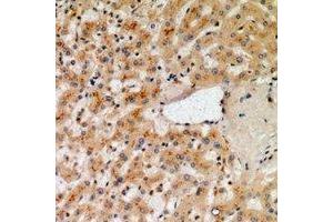 Immunohistochemical analysis of NOX1 staining in human liver formalin fixed paraffin embedded tissue section.