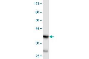 WNK4 anticorps  (AA 1144-1243)