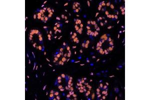 Immunofluorescence (IF) image for anti-Structural Maintenance of Chromosomes 1A (SMC1A) (C-Term) antibody (ABIN7455193) (Recombinant SMC1A antibody  (C-Term))