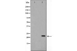 Western blot analysis on Jurkat cell lysate using AKAP14 Antibody,The lane on the left is treated with the antigen-specific peptide. (AKAP14 antibody  (N-Term))
