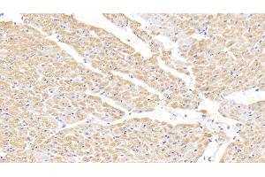 anti-Fatty Acid Binding Protein 3, Muscle and Heart (FABP3) (AA 1-133) antibody