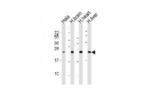 All lanes : Anti-SD Antibody at 1:2000 dilution Lane 1: Hela whole cell lysates Lane 2: human brain lysates Lane 3: human heart lysates Lane 4: human liver lysates Lysates/proteins at 20 μg per lane. (SOD2 antibody)