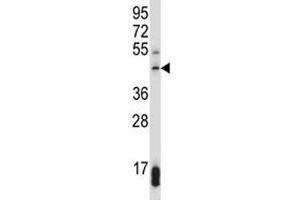 SUV39H1 antibody western blot analysis in 293 lysate.